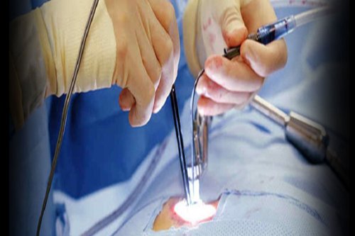 Keyhole Spine Surgery In Nagpur