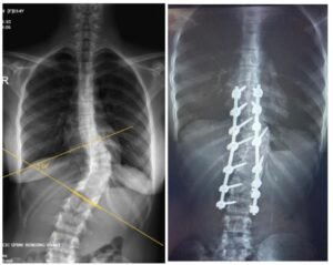 Case 1
