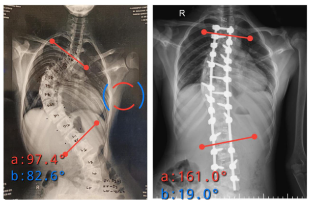 Dr. Paresh Bang 90 degree